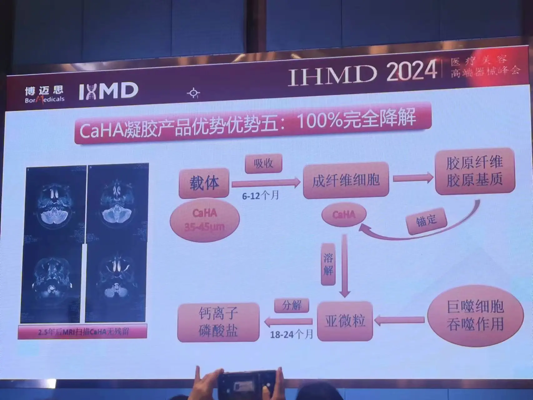 关于羟基磷灰石的100%降解(来自IHMD分享）