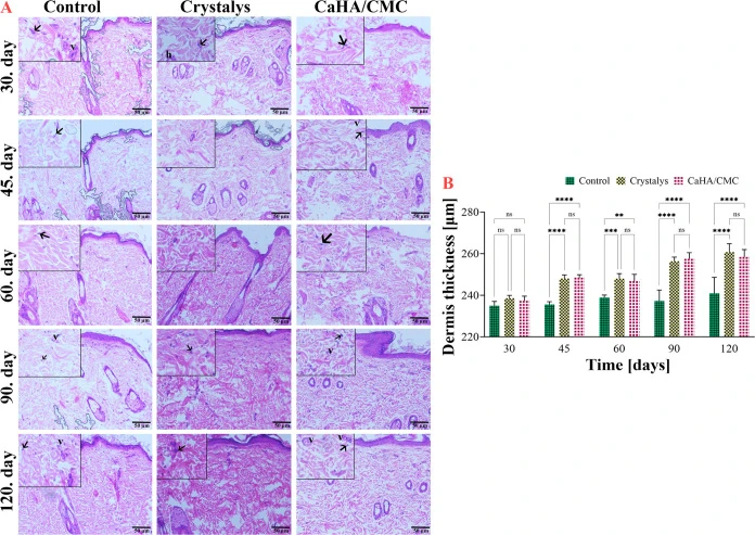 Original H&E histology time series for a rat subcutaneous CaHA/CMC model
